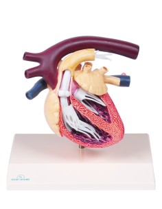 Erler Zimmer EZ-VET1260 Heart Model with Heartworm