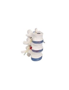 Erler Zimmer anatomical teaching model of 3 lumbar...