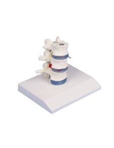 Erler Zimmer anatomical teaching model of 3 lumbar...