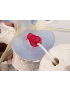 Erler Zimmer anatomical teaching model of 3 lumbar... 2