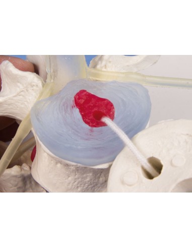 Erler Zimmer anatomical teaching model of 3...