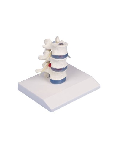 Erler Zimmer anatomical teaching model of 3...