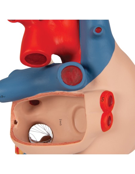 3B Scientific, modello di cuore con bypass, ingrandito 2 volte, scomponibile in 4 parti, G06