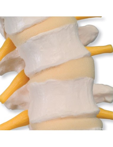 3B Scientific, Flexible spine with soft...