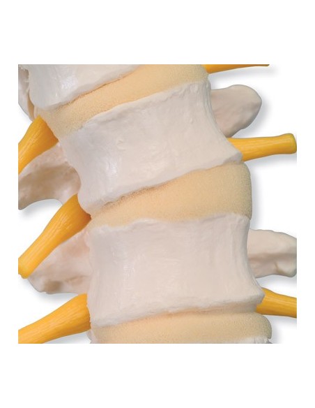 3B Scientific, Flexible spine with soft intervertebral discs VB84