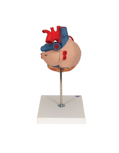 3B Científico, modelo de corazón con bypass,...