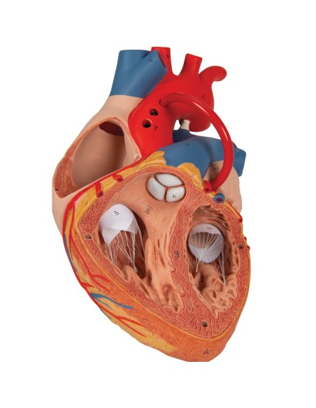 3B Scientific, heart model with bypass, magnified 2 times, decomposable into 4 parts, G06