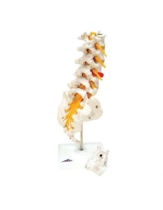 Colonna vertebrale lombare 3B Scientific con ernia del...