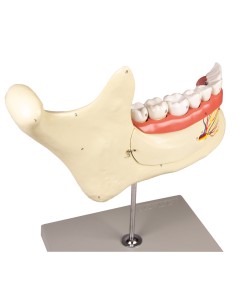 Anatomical model of lower jaw, decomposable into 6 parts...