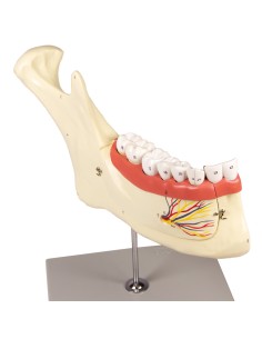 Anatomical model of lower jaw, decomposable into 6 parts... 2