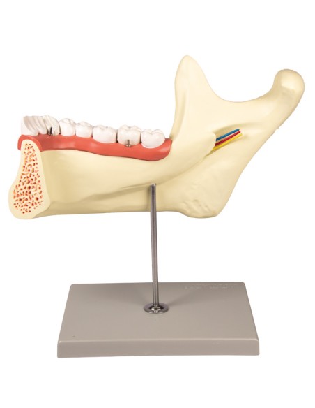 Anatomical model of lower jaw, decomposable into 6 parts Erler Zimmer D125