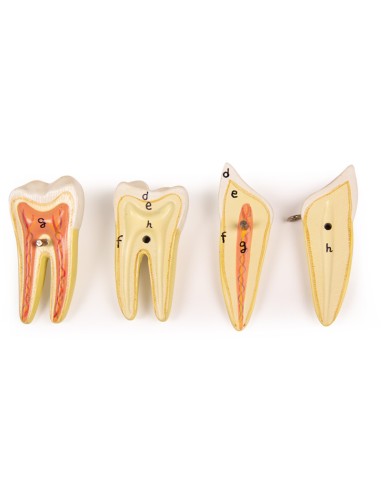 Anatomical model of lower jaw, decomposable...