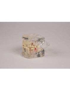 Erler Zimmer, anatomical model of transparent mandible,...