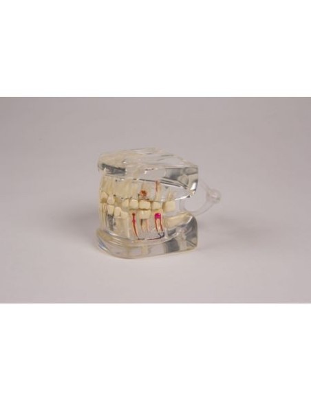 Erler Zimmer, anatomical model of transparent mandible, with D19 teeth