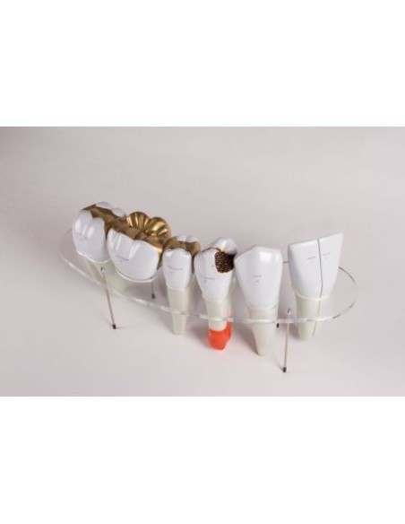 Erler Zimmer, serielles anatomisches Modell der Zahnmorphologie, 10-fach vergrößert R10125