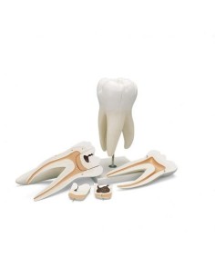 3B Scientific, three-root upper molar tooth model, in 5...