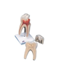 3B Scientific, modello di dente molare superiore a tre...
