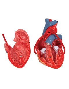 3B Scientific, Heart, classic model, with bypass,... 2
