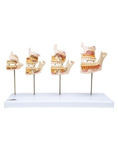 3B Scientific, anatomical model of tooth development D20