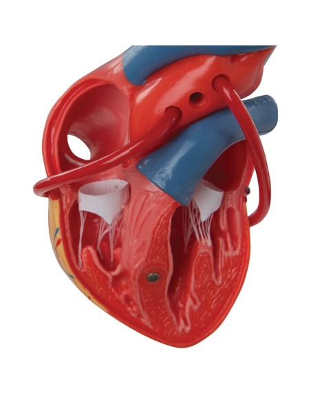 3B Scientific, Heart, classic model, with bypass, decomposable into 2 parts G05