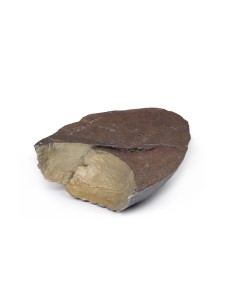 Poumon droit, ablation du hile - Erler Zimmer 3D anatomy... 2