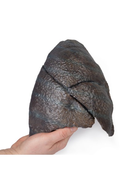 Poumon droit, ablation du hile - Erler Zimmer 3D anatomy Series MP1126