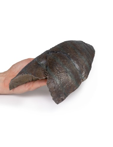 Poumon droit, ablation du hile - Erler Zimmer...