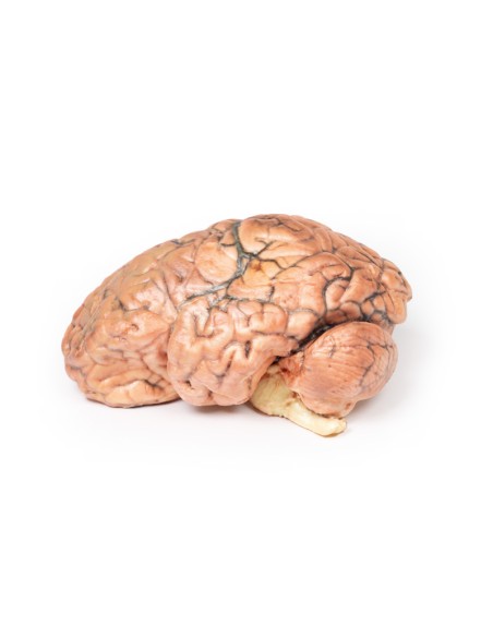 Craneofaringioma - Erler Zimmer 3D anatomy Series MP2017