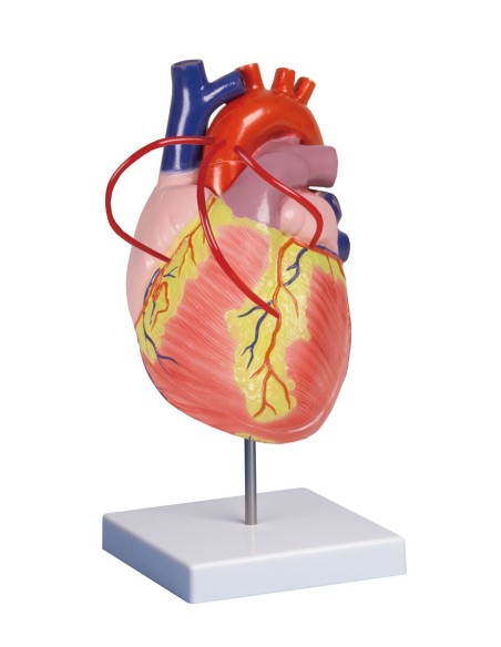Erler Zimmer, anatomical model of heart with bypass, enlarged twice, decomposable into 2 parts G206