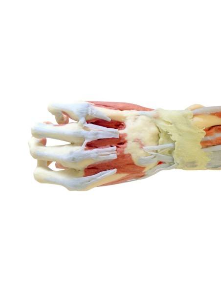 Disección profunda del miembro superior y la mano - Erler Zimmer 3D anatomy Series MP1513