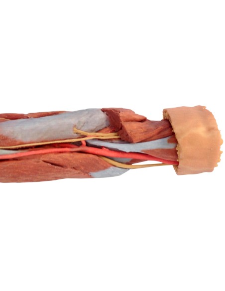 Deep dissection of the upper limb and hand - Erler Zimmer 3D anatomy Series MP1513