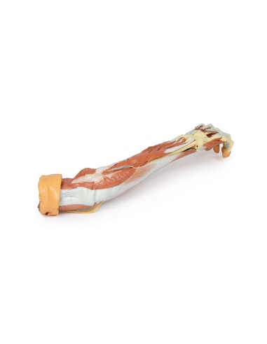 Dissection profonde du membre supérieur et de...