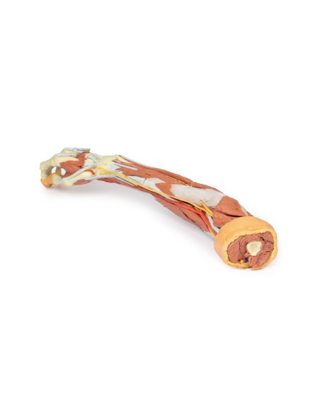 Deep dissection of the upper limb and hand - Erler Zimmer 3D anatomy Series MP1513