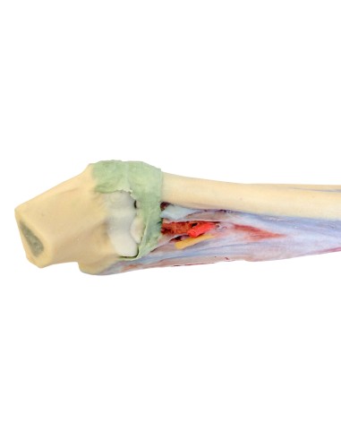 Disección profunda de antebrazo y mano - Erler...