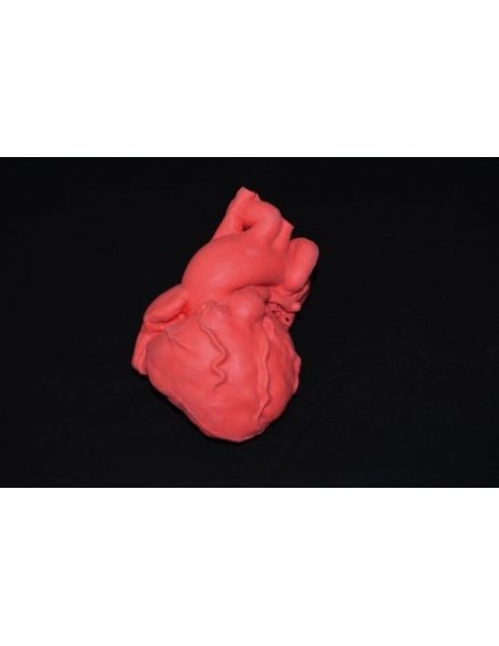 Pediatric heart with tetralogy of Fallot - Erler Zimmer G580