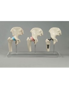 Erler Zimmer, modello anatomico di articolazione...