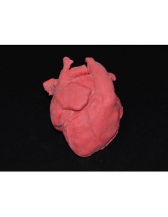 Corazón pediátrico con transposición corregida de las...