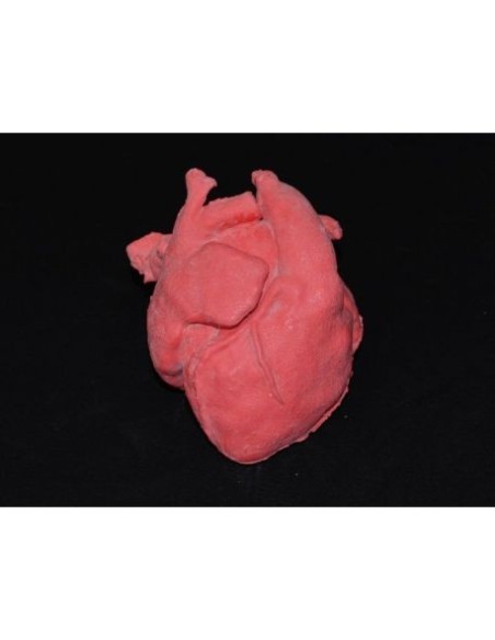 Pediatric heart with corrected transposition of the great arteries and ventricular septal pathology (VSD) - Erler Zimmer G570