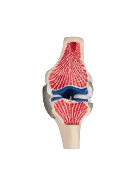 Erler Zimmer, Longitudinal section of knee joint 4570