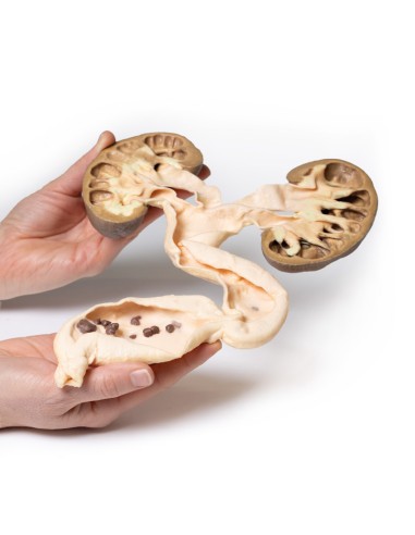 hydronephrosis and hydroureters - Erler Zimmer...