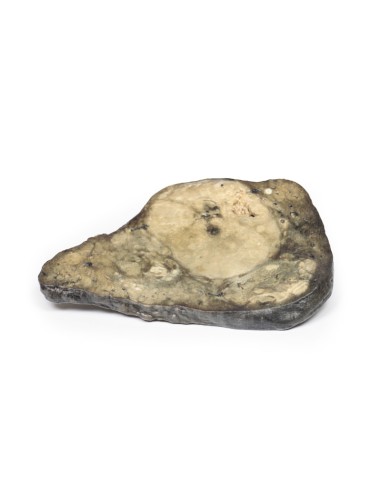 Carcinoma hepatocelular - Erler Zimmer 3D...