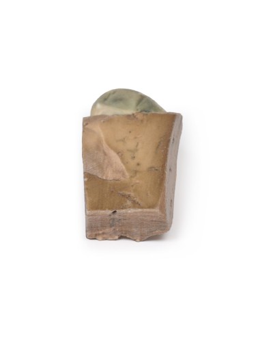 Colelitiasi (calcoli biliari)- Erler Zimmer 3D...