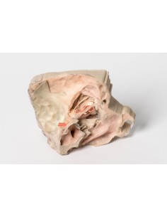 Medialer Orbit - Erler Zimmer 3D Anatomie Serie MP1685 2