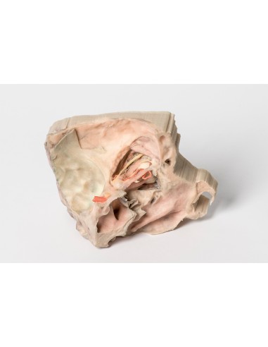 Órbita medial - Erler Zimmer 3D anatomy Series...