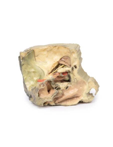 Órbita medial - Erler Zimmer 3D anatomy Series MP1685