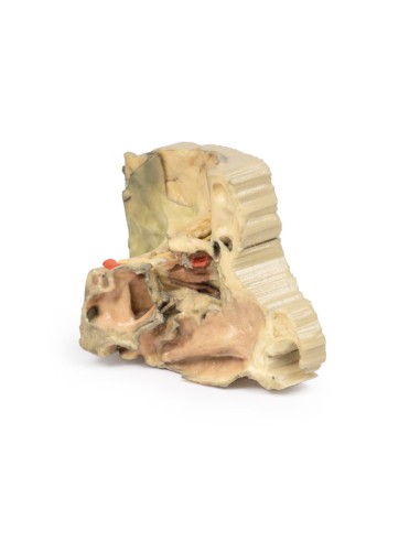 Medialer Orbit - Erler Zimmer 3D Anatomie Serie...