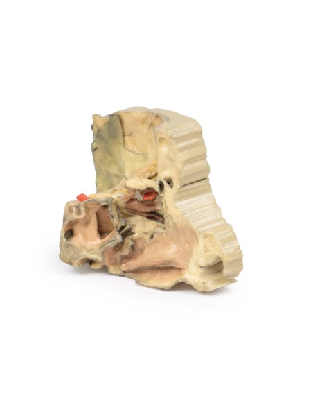 Órbita medial - Erler Zimmer 3D anatomy Series MP1685