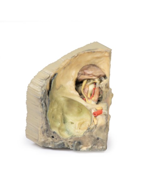 Orbite médiale - Erler Zimmer 3D anatomy Series MP1685