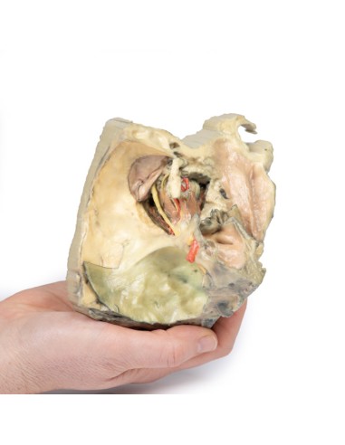 Medialer Orbit - Erler Zimmer 3D Anatomie Serie...