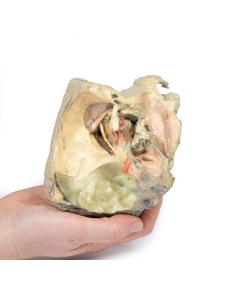 Orbite médiale - Erler Zimmer 3D anatomy Series MP1685